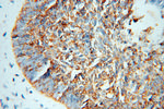 NSDHL Antibody in Immunohistochemistry (Paraffin) (IHC (P))