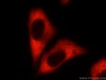 CAPRIN1 Antibody in Immunocytochemistry (ICC/IF)