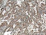 HYAL2 Antibody in Immunohistochemistry (Paraffin) (IHC (P))