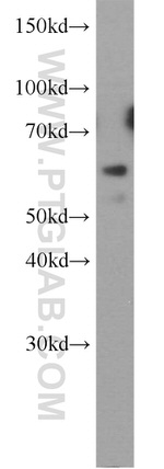 HYAL2 Antibody in Western Blot (WB)