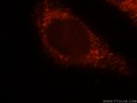 HSD17B4 Antibody in Immunocytochemistry (ICC/IF)