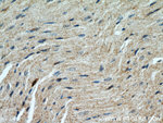 HSD17B4 Antibody in Immunohistochemistry (Paraffin) (IHC (P))