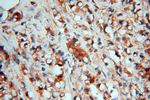 HSD17B4 Antibody in Immunohistochemistry (Paraffin) (IHC (P))