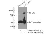 HSD17B4 Antibody in Immunoprecipitation (IP)