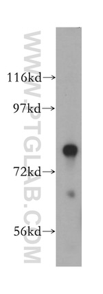 HSD17B4 Antibody in Western Blot (WB)