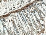 LMOD1 Antibody in Immunohistochemistry (Paraffin) (IHC (P))