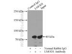 LMOD1 Antibody in Immunoprecipitation (IP)