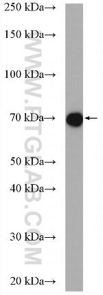 LMOD1 Antibody in Western Blot (WB)