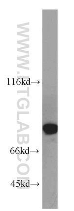 LMOD1 Antibody in Western Blot (WB)