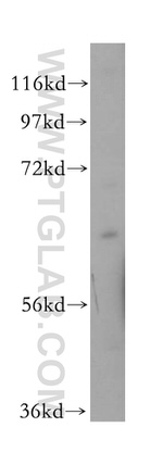 LMOD1 Antibody in Western Blot (WB)