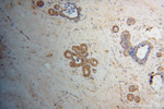 HCCS Antibody in Immunohistochemistry (Paraffin) (IHC (P))