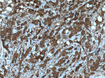 HCCS Antibody in Immunohistochemistry (Paraffin) (IHC (P))