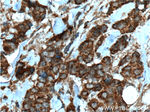 HCCS Antibody in Immunohistochemistry (Paraffin) (IHC (P))