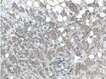 HCCS Antibody in Immunohistochemistry (Paraffin) (IHC (P))