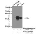 HCCS Antibody in Immunoprecipitation (IP)