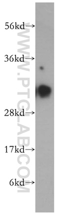 HCCS Antibody in Western Blot (WB)