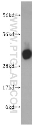 HCCS Antibody in Western Blot (WB)