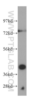 SCAMP2 Antibody in Western Blot (WB)