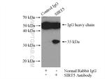 SIRT5 Antibody in Immunoprecipitation (IP)