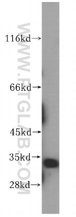 SIRT5 Antibody in Western Blot (WB)