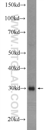 SIRT5 Antibody in Western Blot (WB)