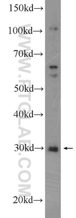 SIRT5 Antibody in Western Blot (WB)