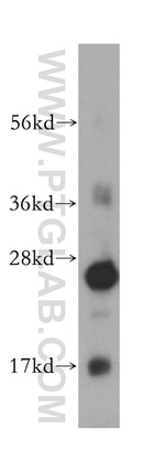 GSTO1 Antibody in Western Blot (WB)