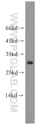 GSTO1 Antibody in Western Blot (WB)