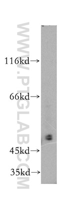 OGG1 Antibody in Western Blot (WB)