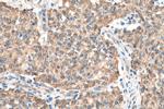 ALADIN Antibody in Immunohistochemistry (Paraffin) (IHC (P))