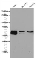 ALADIN Antibody in Western Blot (WB)