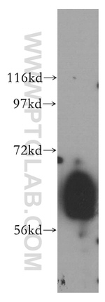 ALADIN Antibody in Western Blot (WB)