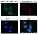 ALADIN Antibody in Immunocytochemistry (ICC/IF)