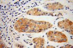 ALADIN Antibody in Immunohistochemistry (Paraffin) (IHC (P))