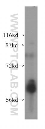 ALADIN Antibody in Western Blot (WB)