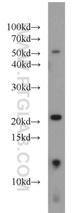 NHP2 Antibody in Western Blot (WB)