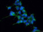 ABLIM1 Antibody in Immunocytochemistry (ICC/IF)