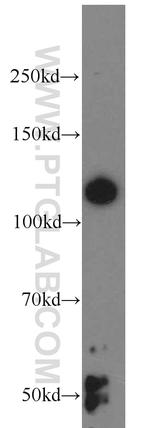 ABLIM1 Antibody in Western Blot (WB)