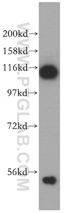 ABLIM1 Antibody in Western Blot (WB)