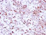 Cathepsin K Antibody in Immunohistochemistry (Paraffin) (IHC (P))