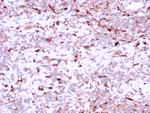 Cathepsin K Antibody in Immunohistochemistry (Paraffin) (IHC (P))