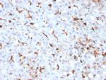 Cathepsin K Antibody in Immunohistochemistry (Paraffin) (IHC (P))