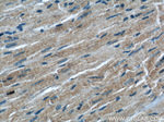 ATG4B Antibody in Immunohistochemistry (Paraffin) (IHC (P))