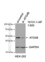 ATG4B Antibody in Western Blot (WB)