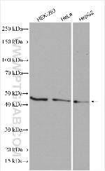 ATG4B Antibody in Western Blot (WB)