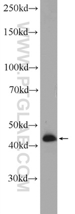 ATG4B Antibody in Western Blot (WB)