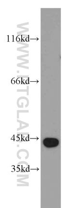 ATG4B Antibody in Western Blot (WB)