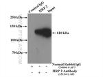 HRP 2 Antibody in Immunoprecipitation (IP)