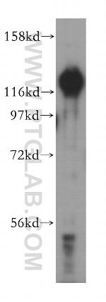 HRP 2 Antibody in Western Blot (WB)
