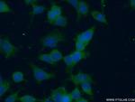 NME3 Antibody in Immunocytochemistry (ICC/IF)